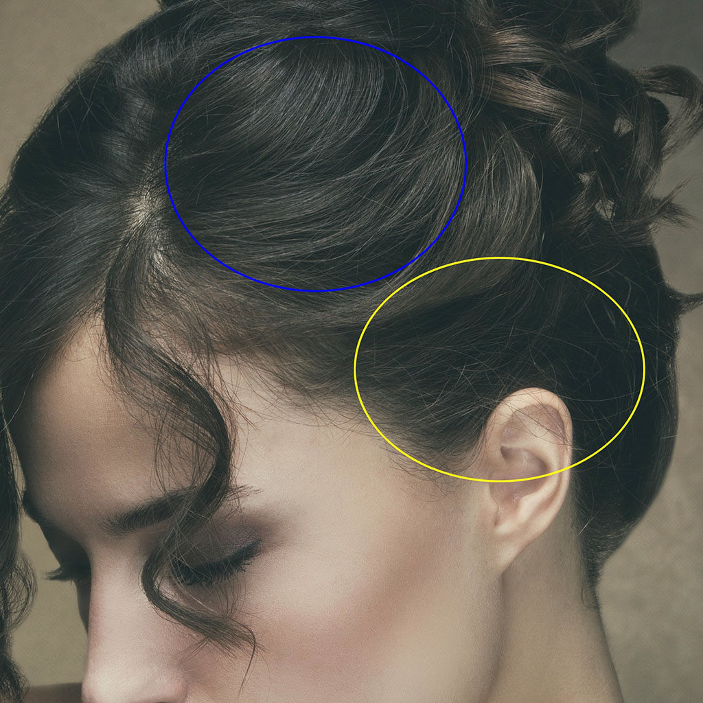 Stock portrait of model showing areas of hair to be corrected circled